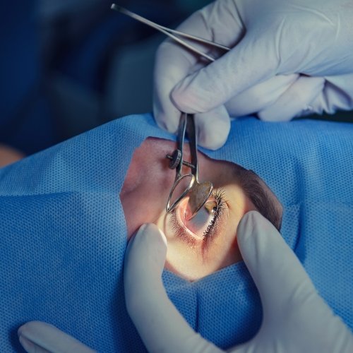 operating-room-eye-surgery-2021-08-26-16-53-24-utc.jpg